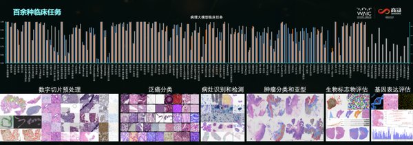 病理AI：从单病种到多病种的革命性跨越