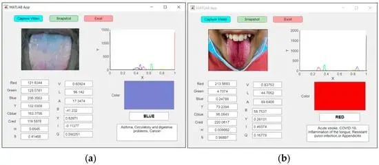 AI舌诊：通过舌头颜色预测疾病的未来医疗革命