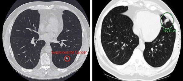 Med-Gemini系列模型：AI医疗影像分析的革命性突破