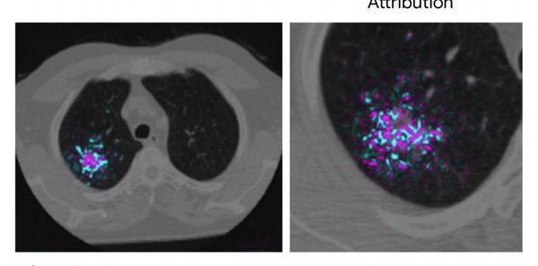 Med-Gemini系列模型：AI医疗影像分析的革命性突破