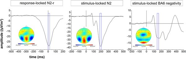 解码动态视觉感知：EEG2Video技术的突破与应用